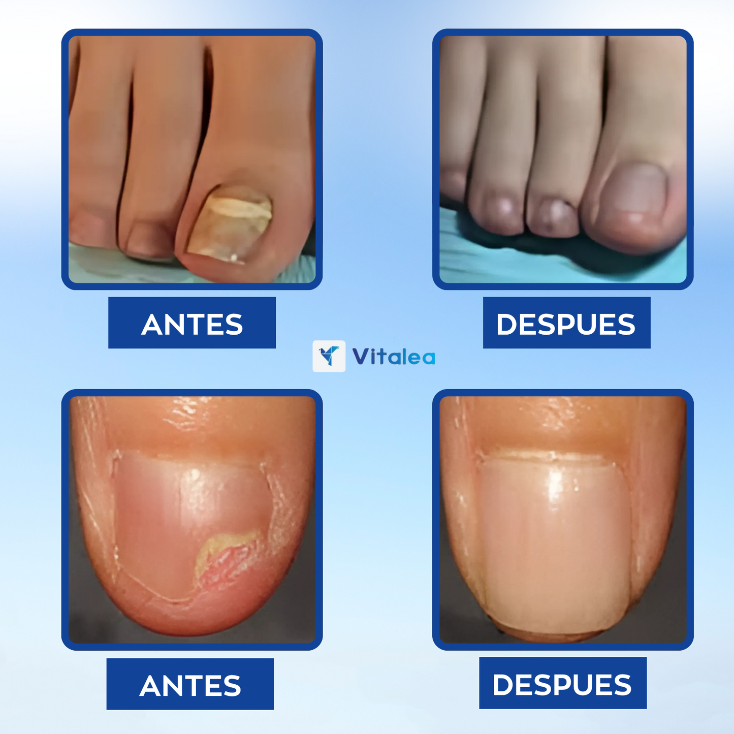 Vitalea NailPro Light™: Salud y belleza al instante para tus uñas