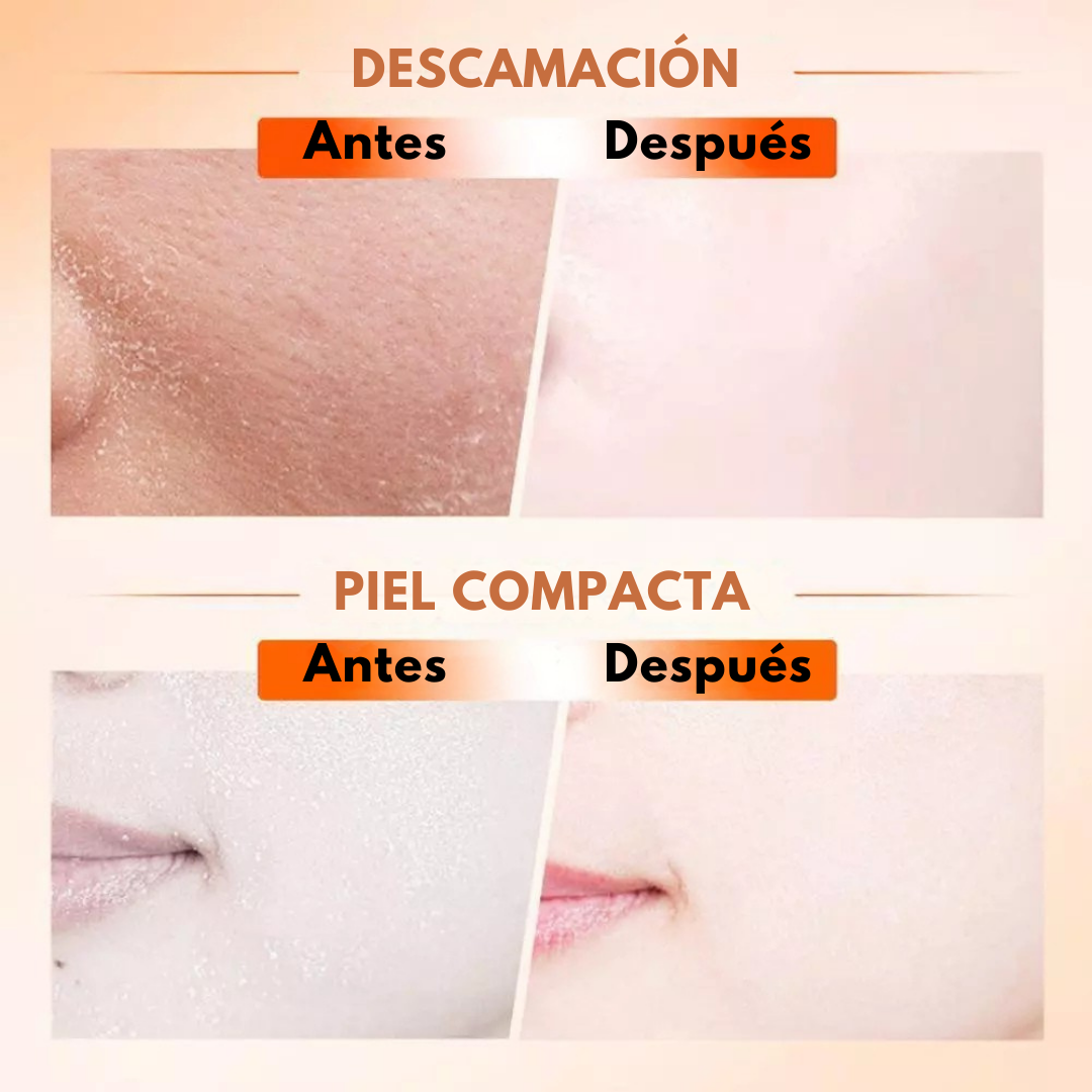 Sanorys Sadoer™ - Ilumina, Reafirma y Borra Años de tu Rostro en Segundos