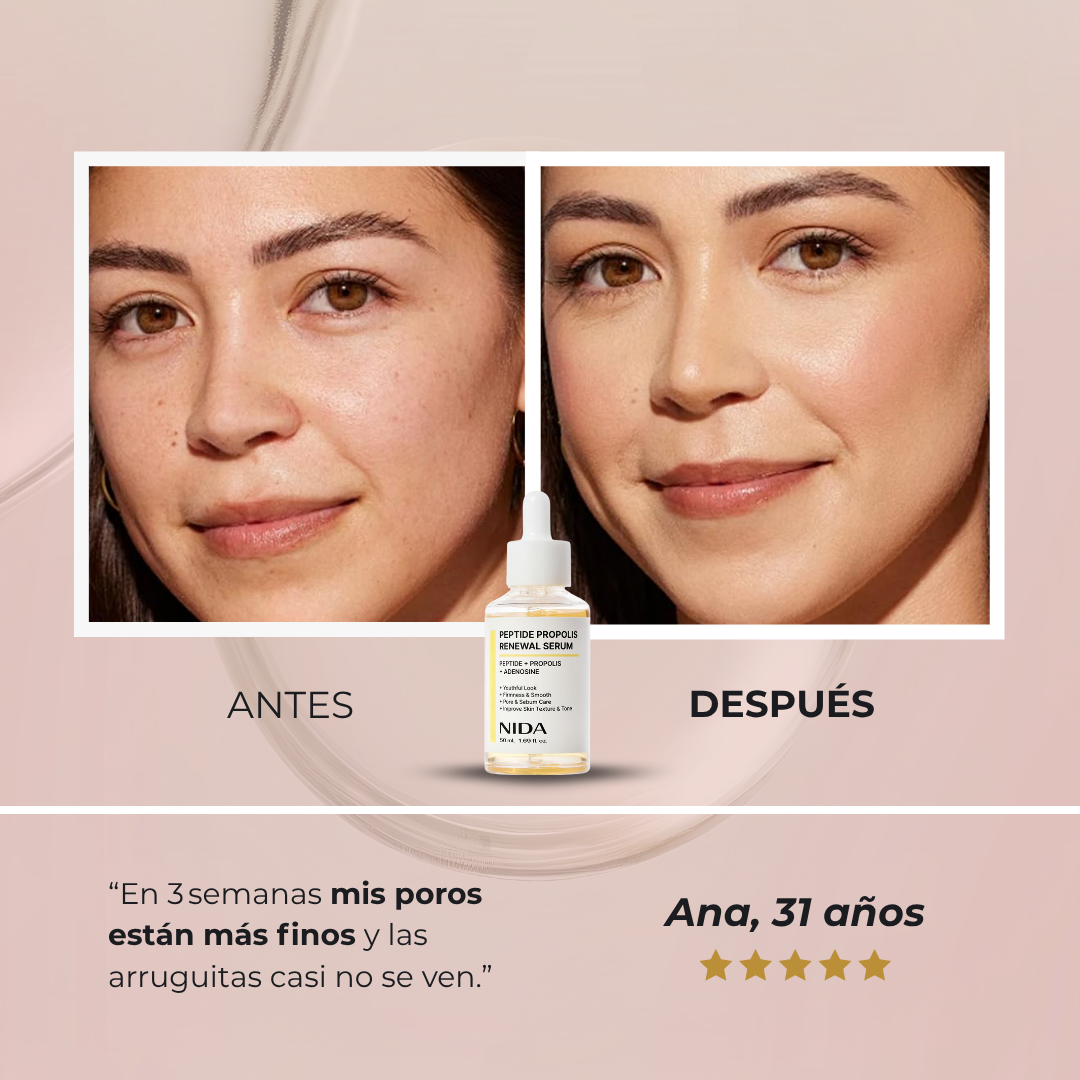 Sérum NIDA™ - Fórmula coreana con péptidos de abeja para eliminar poros por completo