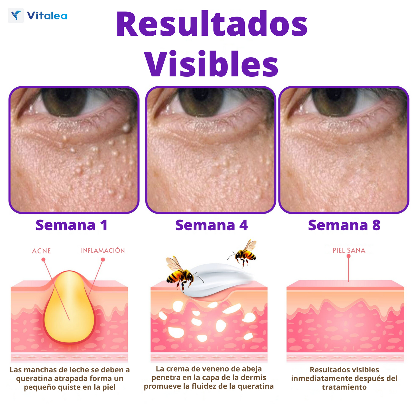 Vitalea HoneyVive🧴 Crema facial Anti-Edad de Colágeno