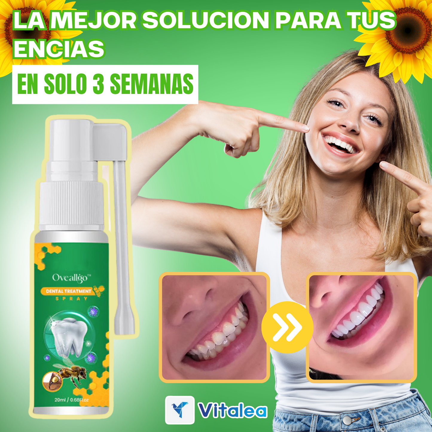 1 + 1 gratis  Dentizen™ - ⛫💨Spray para la regeneración de encías