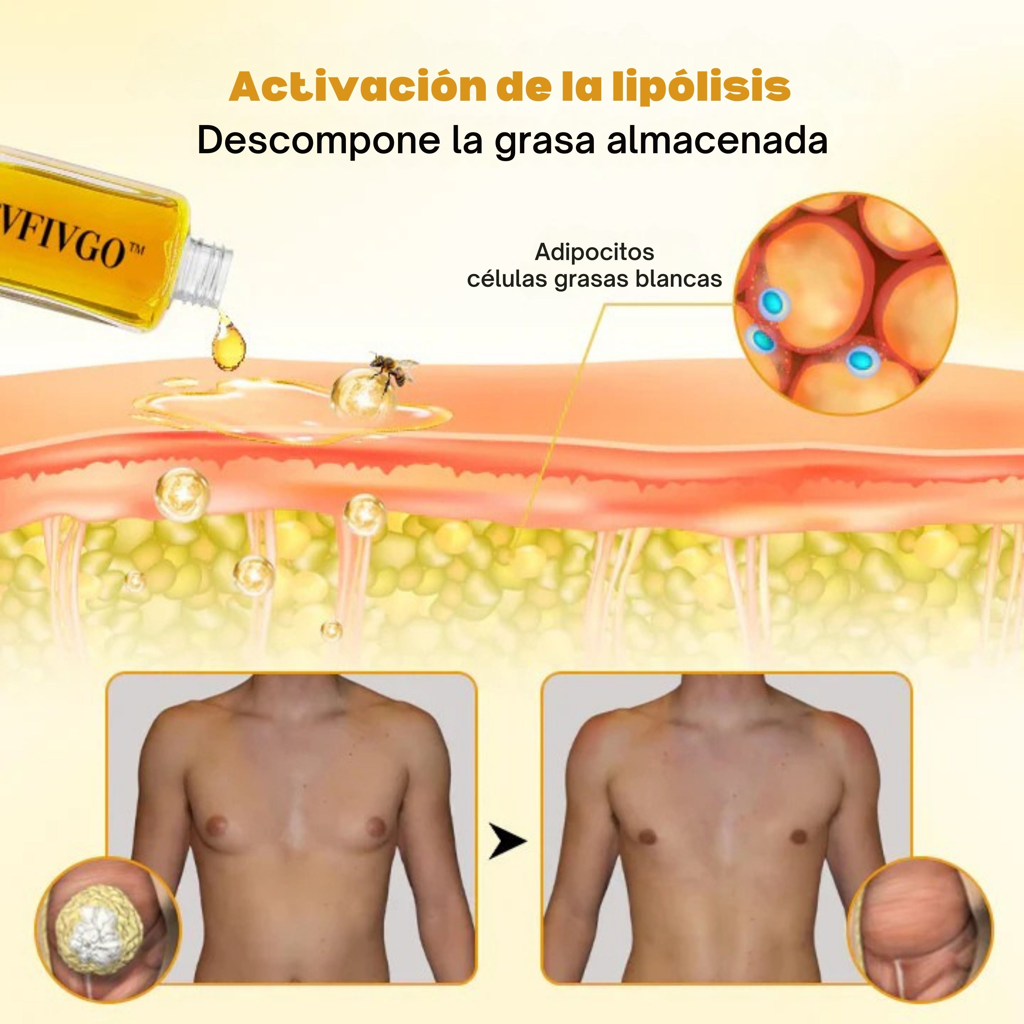 Sanorys ThermoFin™ - Elimina tu ginecomastia en 7 días | 1+1 GRATIS