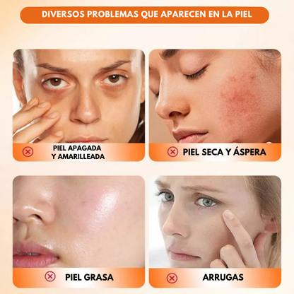 Sanorys Sadoer™ - Ilumina, Reafirma y Borra Años de tu Rostro en Segundos