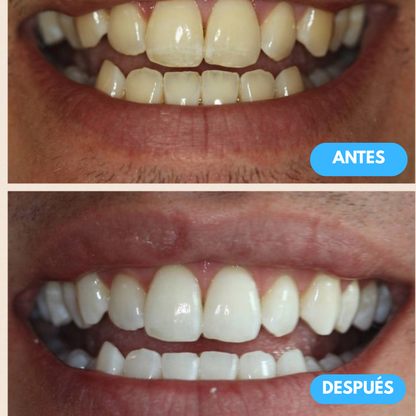 Sanorys™ -  La pasta dental que refresca, blanquea y cuida tu sonrisa desde el primer uso.