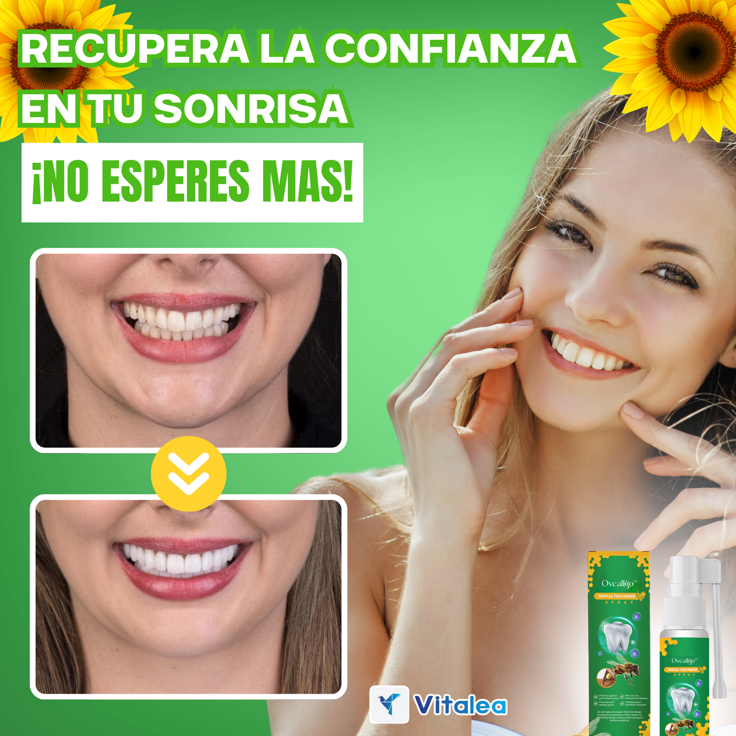 1 + 1 gratis  Dentizen™ - ⛫💨Spray para la regeneración de encías