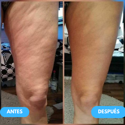 Firmea™ - La forma más rápida de reafirmar tus piernas… sin ejercicio, sin excusas, sin esperar.