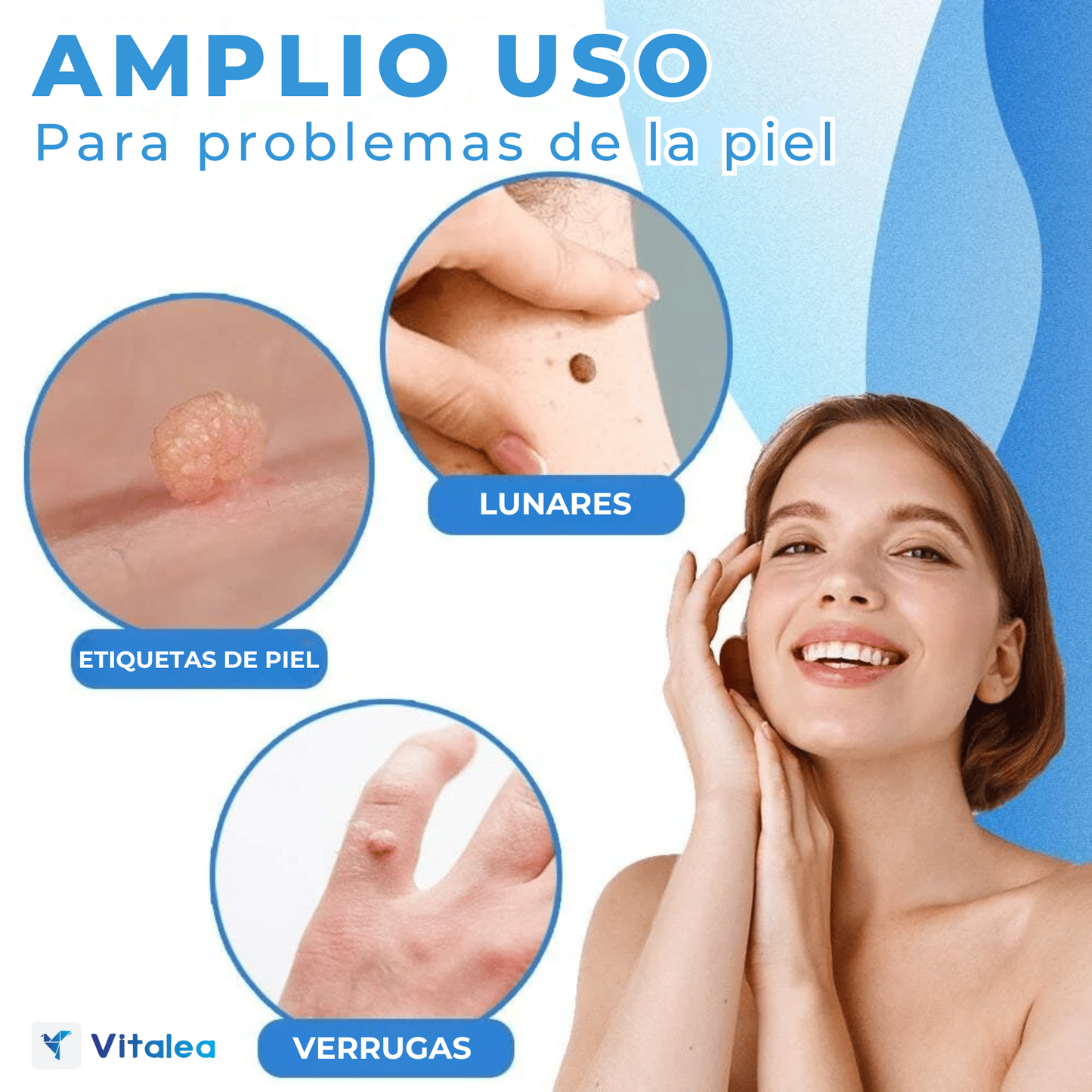1+1 GRATIS| Vitalea PerfectFace™- Kit de eliminación de verrugas natural